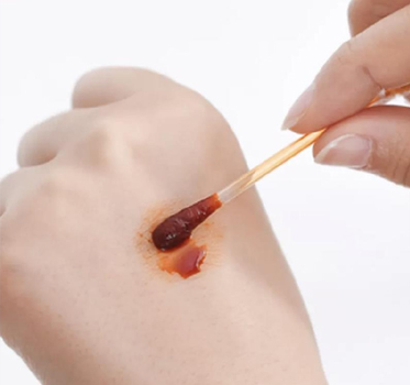 Consommables médicaux